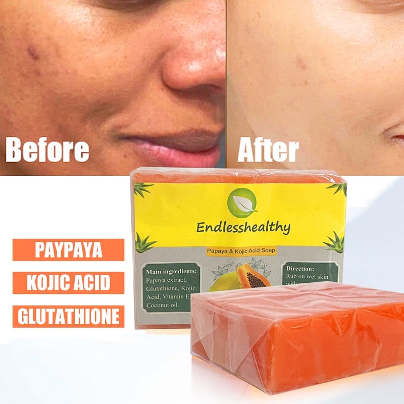 Kojic Acid Soap Before and After: Does It Really Lighten Skin? 13 Kojic Acid Soap Before and After: Does It Really Lighten Skin?