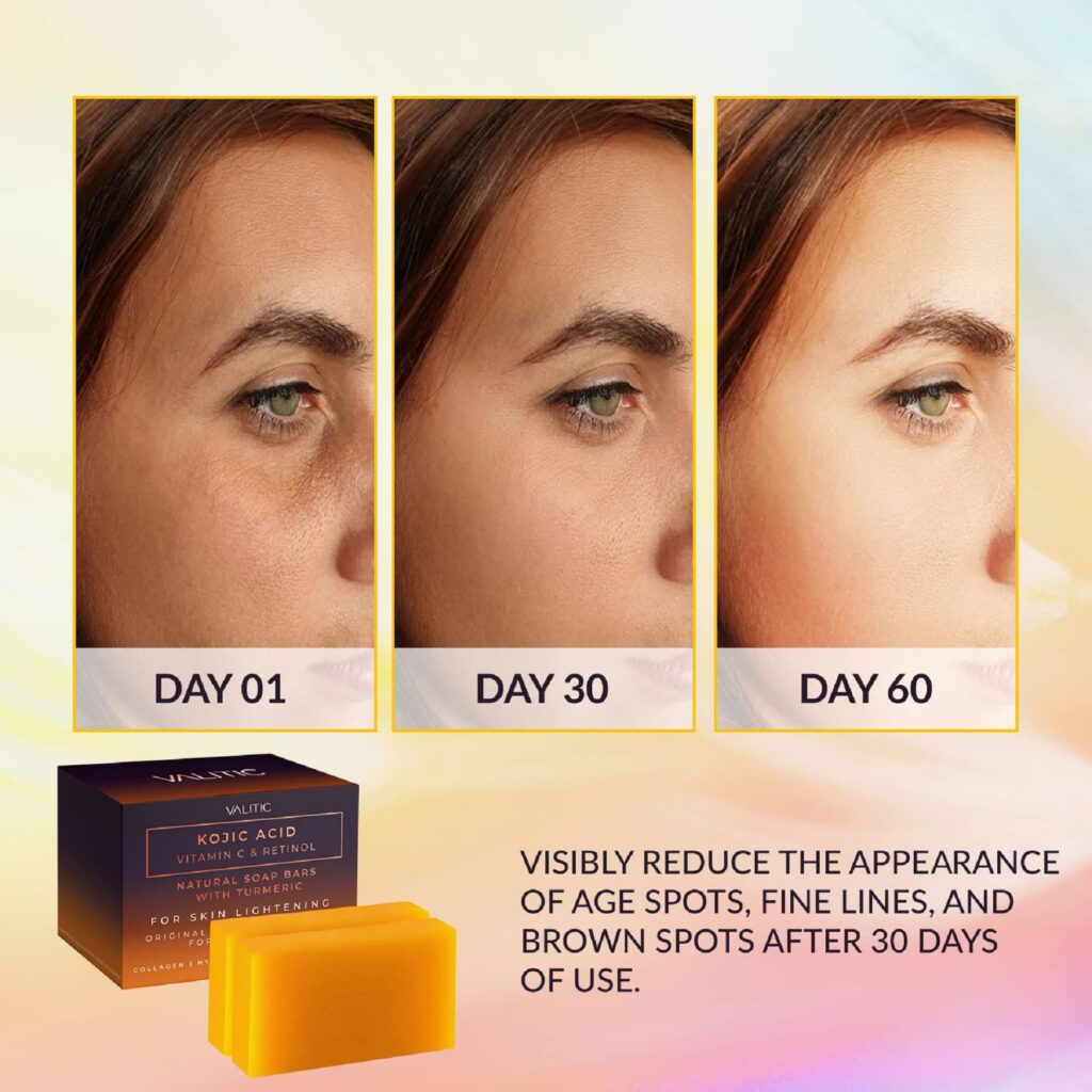 Kojic Acid Soap Before and After: Does It Really Lighten Skin? 3 Kojic Acid Soap Before and After: Does It Really Lighten Skin?