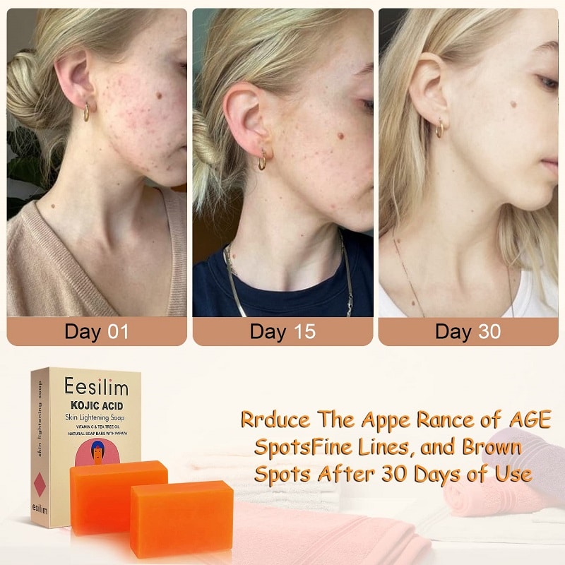 Kojic Acid Soap Before and After: Does It Really Lighten Skin? 4 Kojic Acid Soap Before and After: Does It Really Lighten Skin?