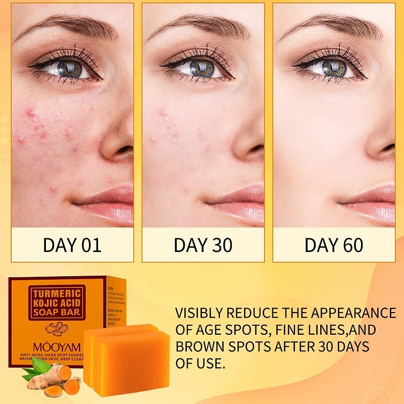 Kojic Acid Soap Before and After: Does It Really Lighten Skin? 5 Kojic Acid Soap Before and After: Does It Really Lighten Skin?