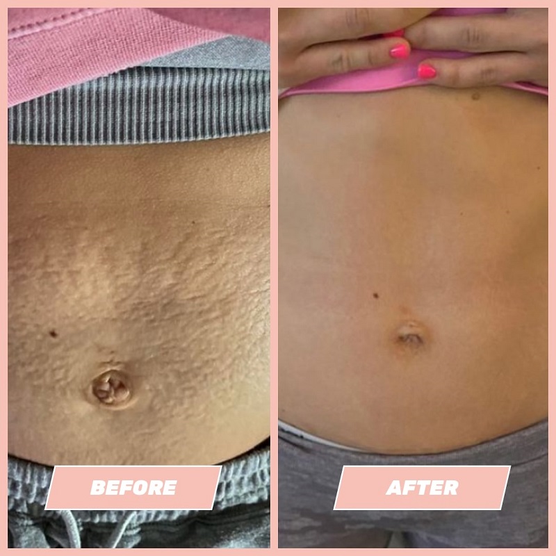 Maelys Cosmetics Before and After: A Comprehensive Review of the Results 7 Maelys Cosmetics Before and After: A Comprehensive Review of the Results