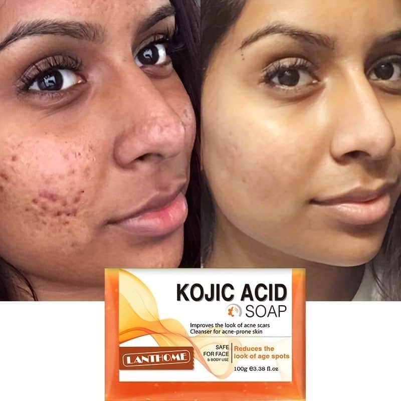 Kojic Acid Soap Before and After: Does It Really Lighten Skin? 8 Kojic Acid Soap Before and After: Does It Really Lighten Skin?